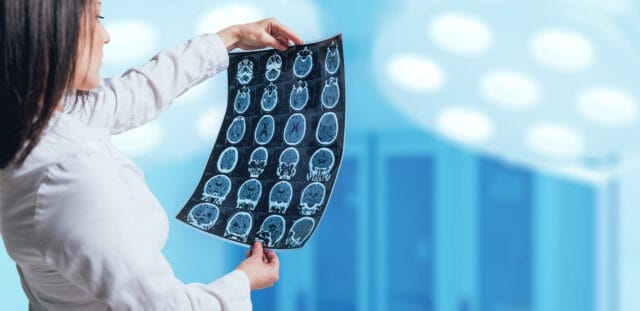 Neurological checkup