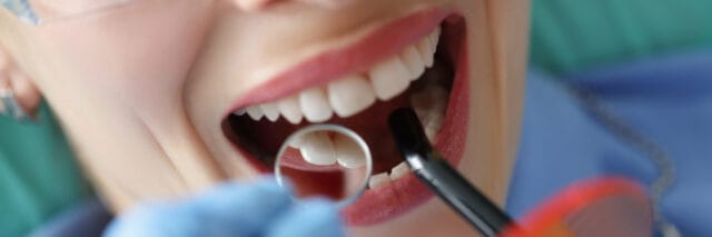 Dental Checkup